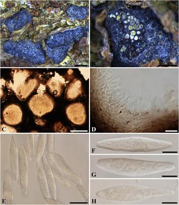 Toward a Natural Classification of Botryosphaeriaceae: A Study of the Type Specimens of Botryosphaeria sensu lato